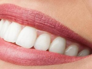 Expert Dental Assistant