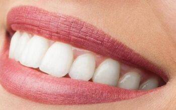 Expert Dental Assistant